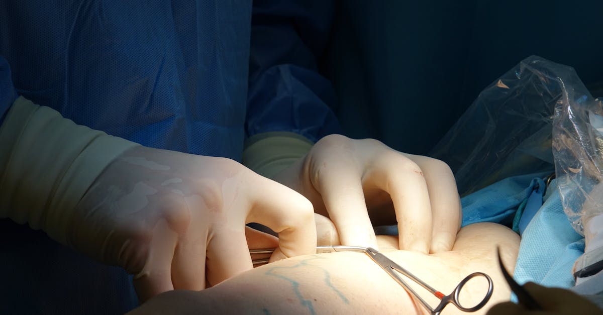 découvrez les avantages du tourisme médical pour des soins de qualité à l'étranger. profitez de services médicaux de pointe et de tarifs avantageux.